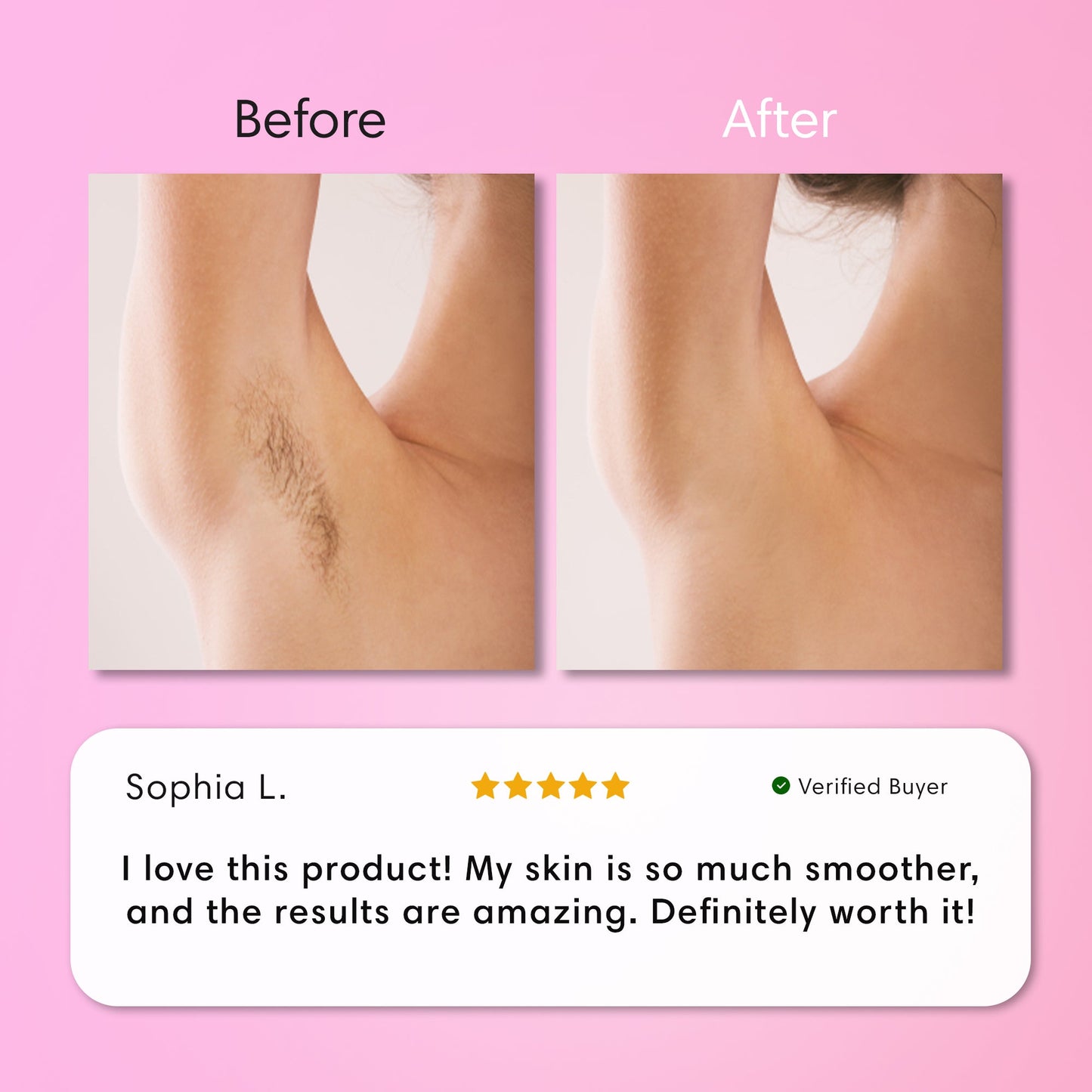 ZENVAROO™ SmoothSkin Hair Removal Cream | Gentle 5-Minute Body Hair Removal