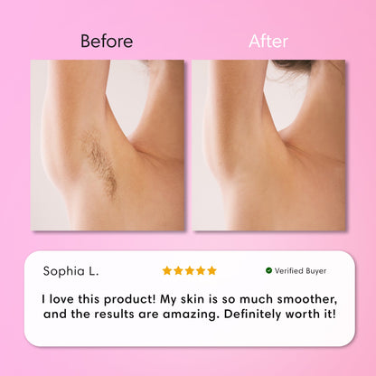 ZENVAROO™ SmoothSkin Hair Removal Cream | Gentle 5-Minute Body Hair Removal