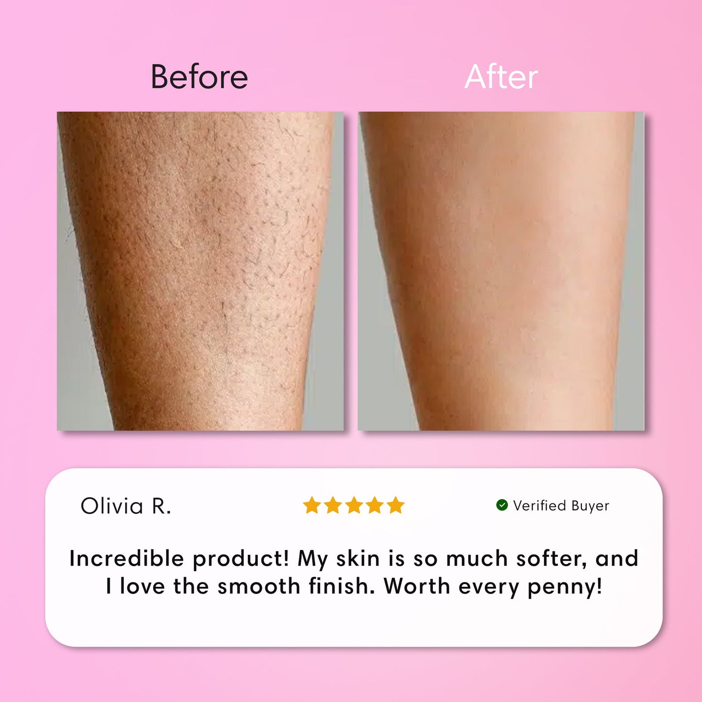 ZENVAROO™ SmoothSkin Hair Removal Cream | Gentle 5-Minute Body Hair Removal
