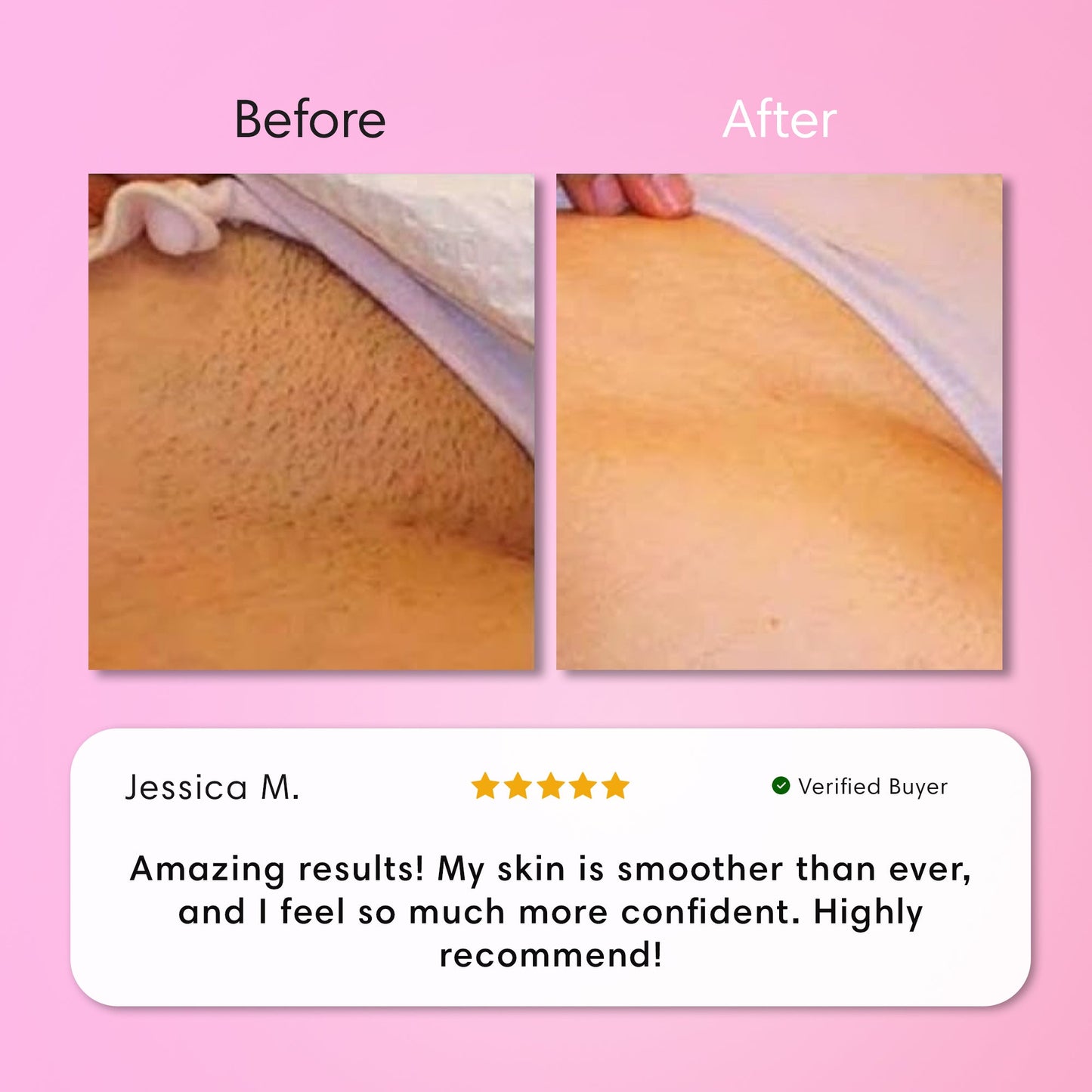 ZENVAROO™ SmoothSkin Hair Removal Cream | Gentle 5-Minute Body Hair Removal